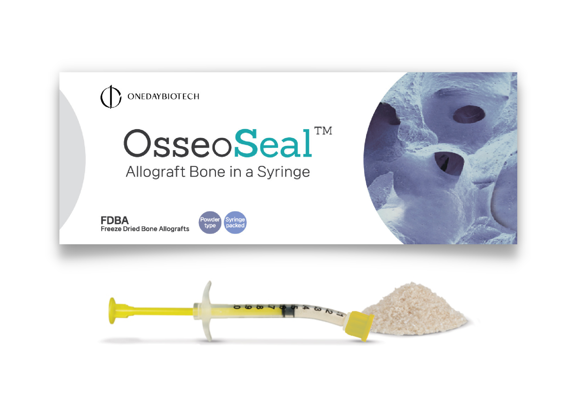 OsseoSeal Prefilled Bone in Syringe